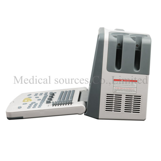 (MS-P800) Escáner de ultrasonido portátil digital de la mejor calidad