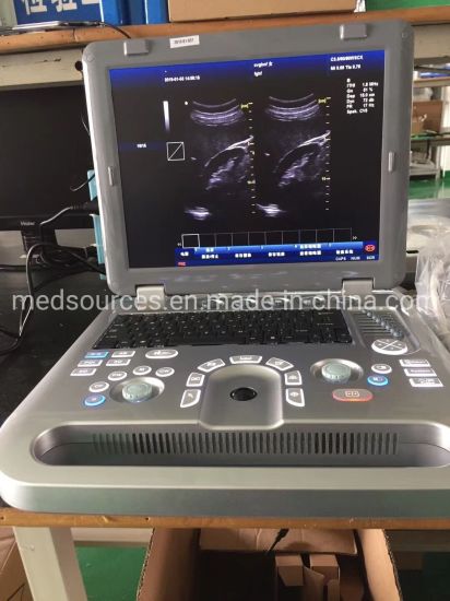 (MS-4500) Escáner portátil portátil Full Digital 3D 4D Echo Color Doppler Ultrasonido Escáner